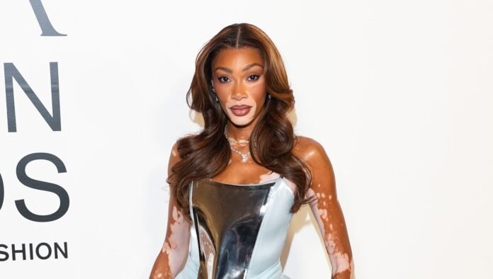 Winnie Harlow’s Net Worth: How Much Money She Makes Now