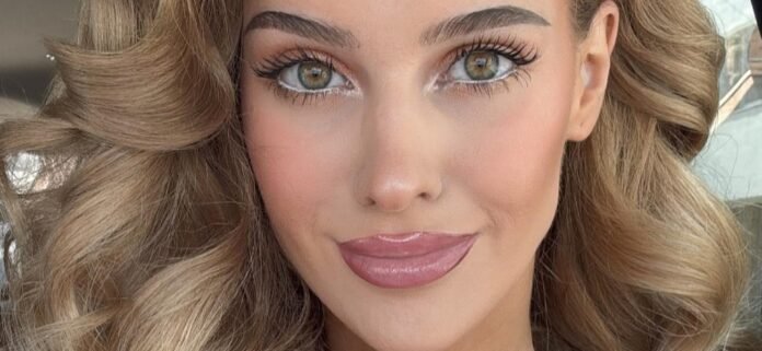 Veronika Rajek Shows Off Her 'Cherries' In Plunging Minidress And High Heels