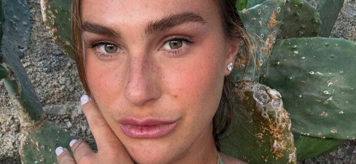 Tennis Player Aryna Sabalenka Poses Topless, But Fans Focus On Her 'Frightening' Lips