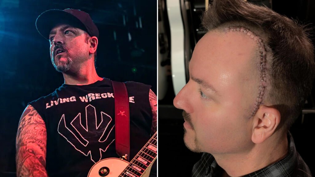 Hatebreed’s Wayne Lozinak “Getting Better Every Day” After Removal of Benign Brain Tumor