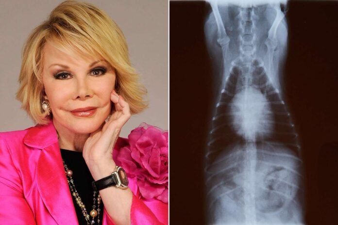 joan-rivers-auction-764-101025-9e4c5e55b95f41f1a6bb34e8711c3cd3.jpg Joan Rivers’ Shag Wigs, Dog’s X-Rays and Royal Family Keepsakes Auctioned Off