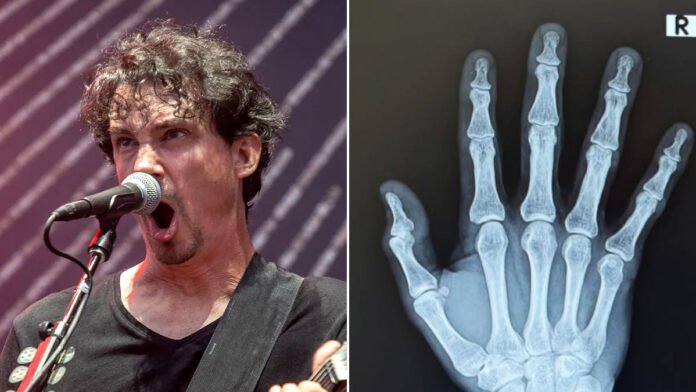 Gojira Frontman Joe Duplantier Undergoes Hand Surgery, Won’t Play Guitar on Upcoming Tour